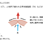 ミックスボイスとは